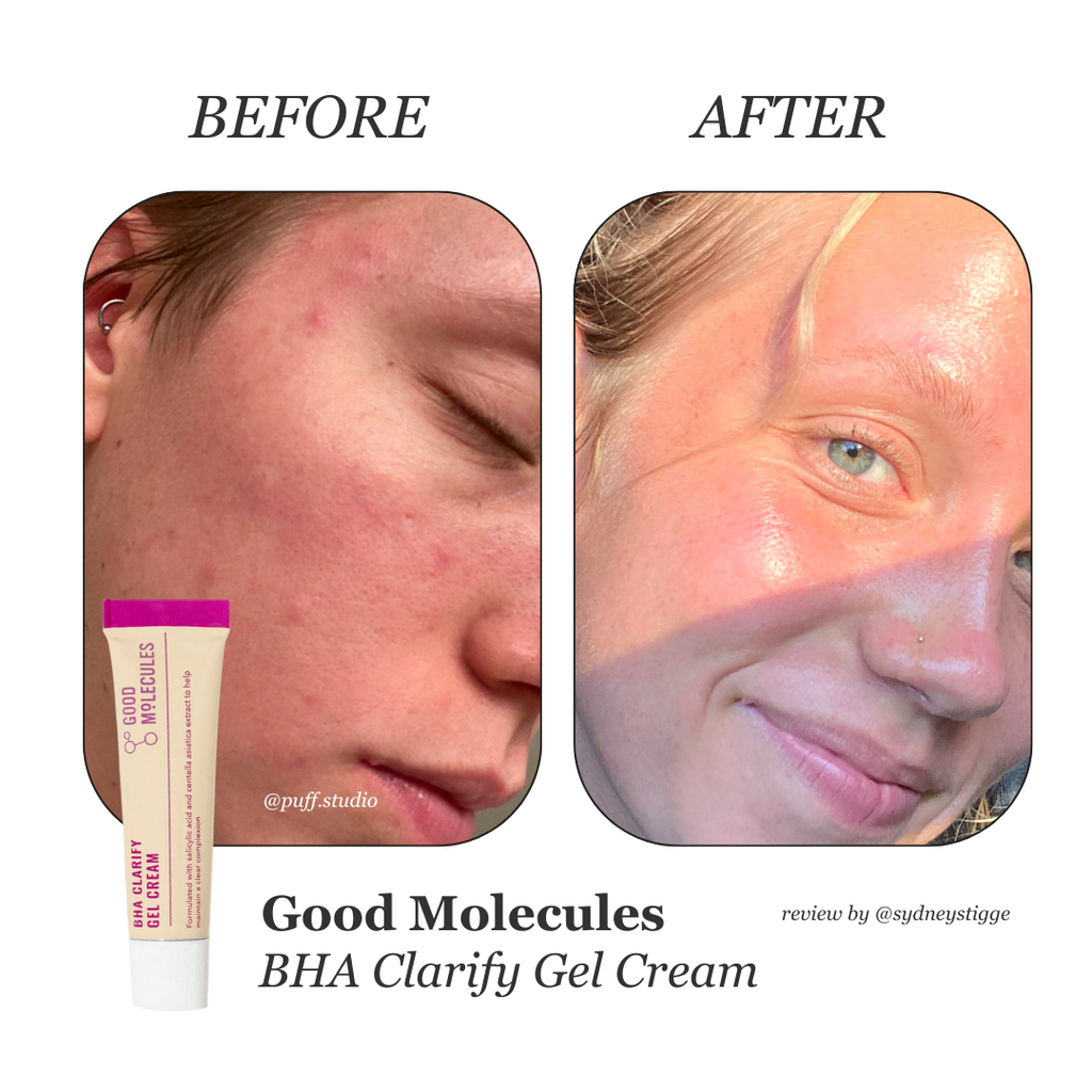 good-molecules-bha-clarify-gel-cream