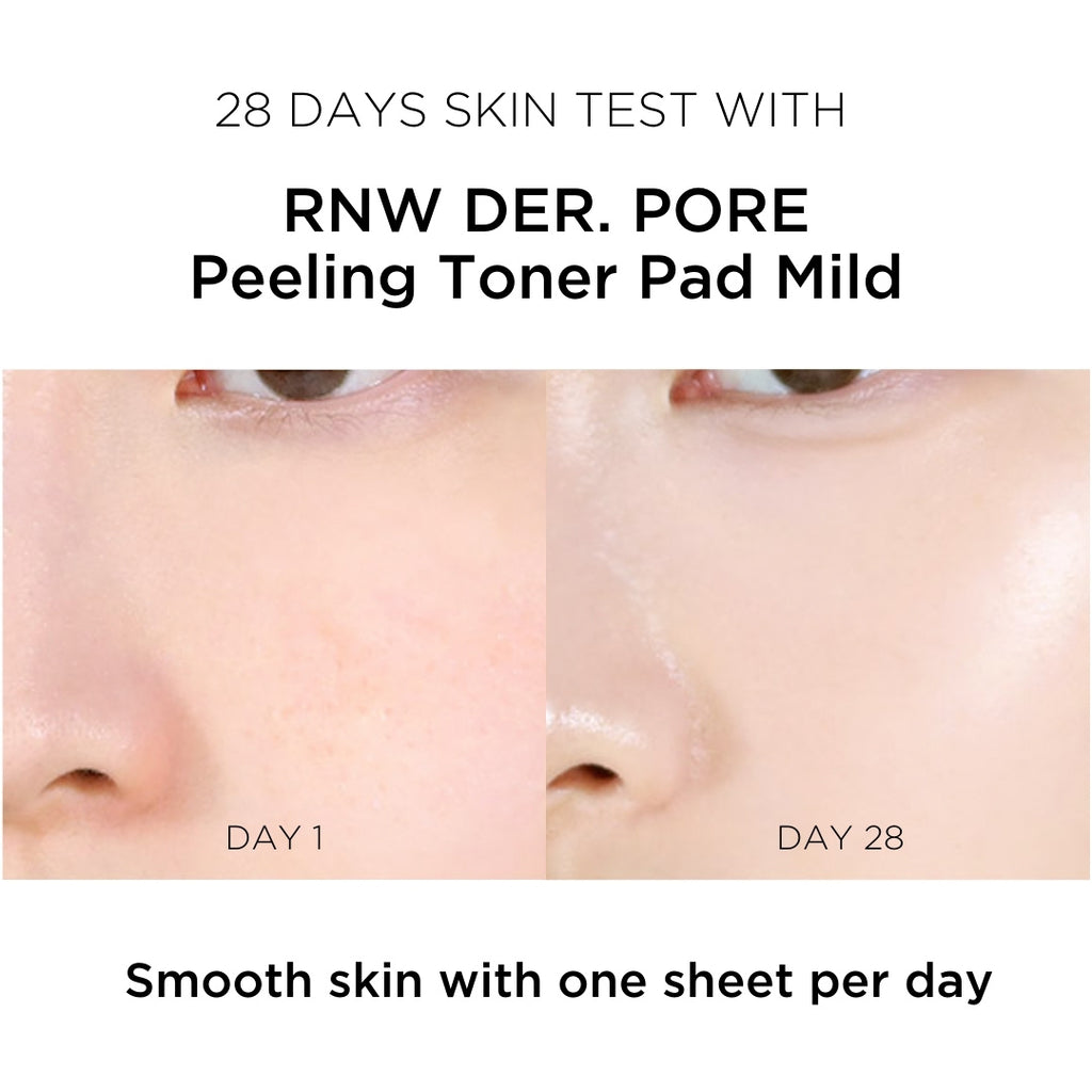 RNW-PEELING-TONER-PAD-MILD