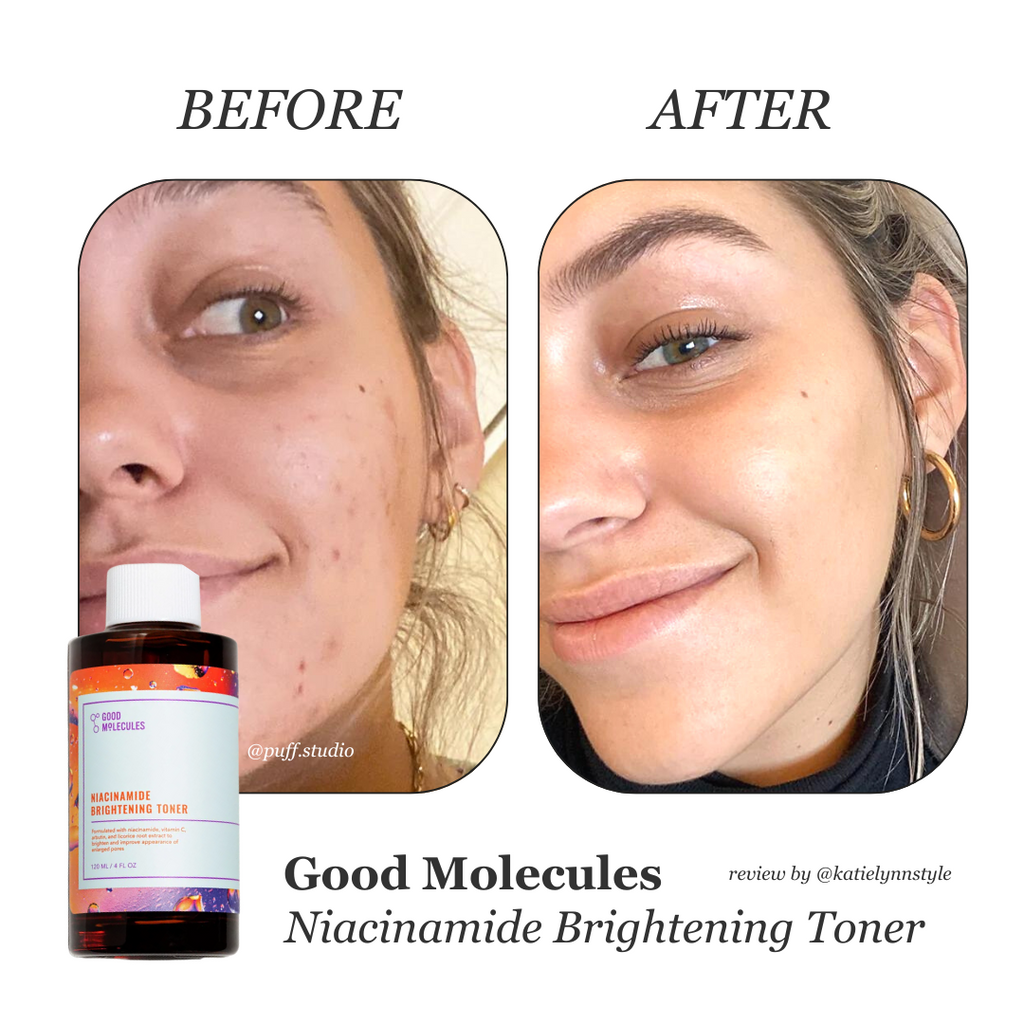 good-molecules-niacinamide-brightening-toner