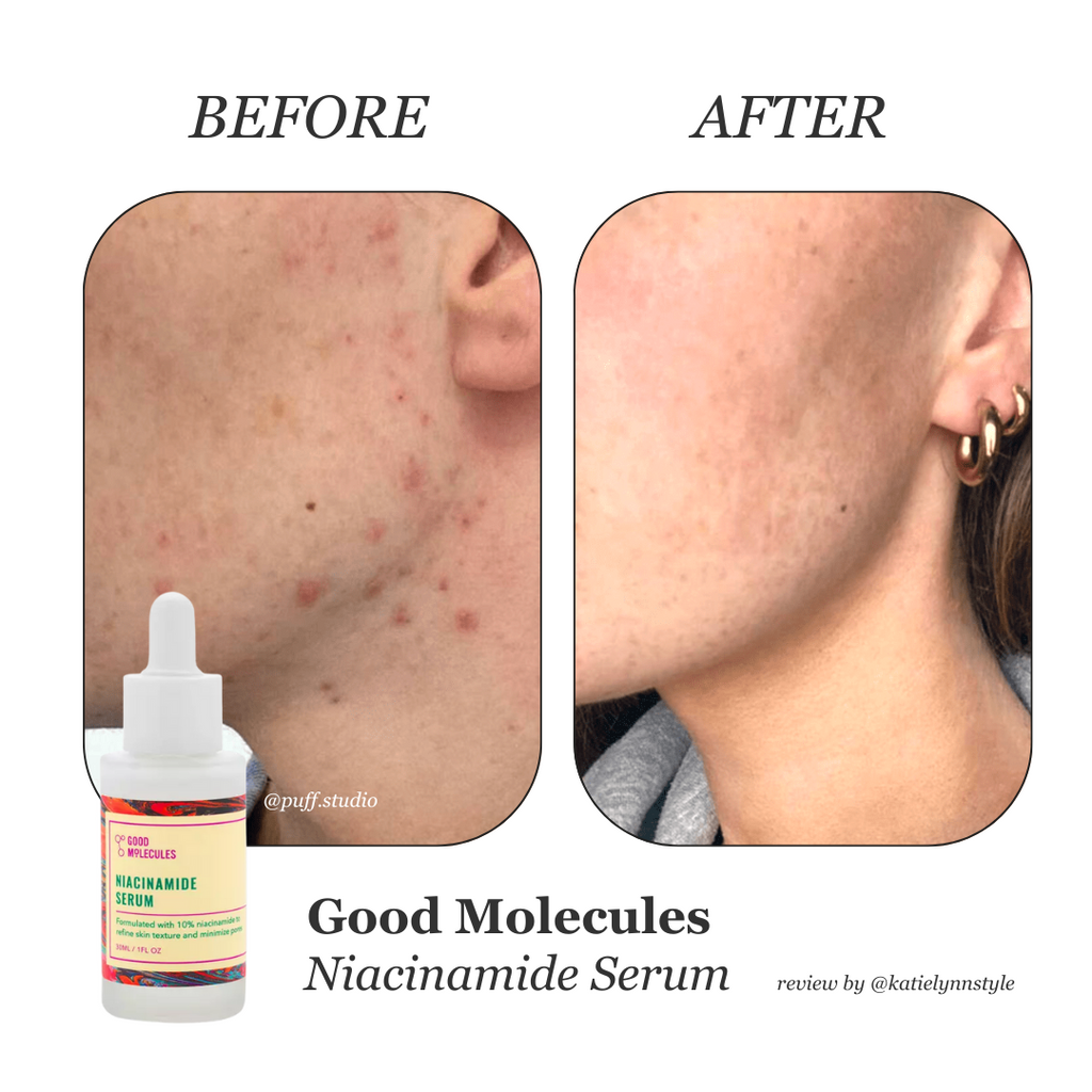 good-molecules-niacinamide-serum