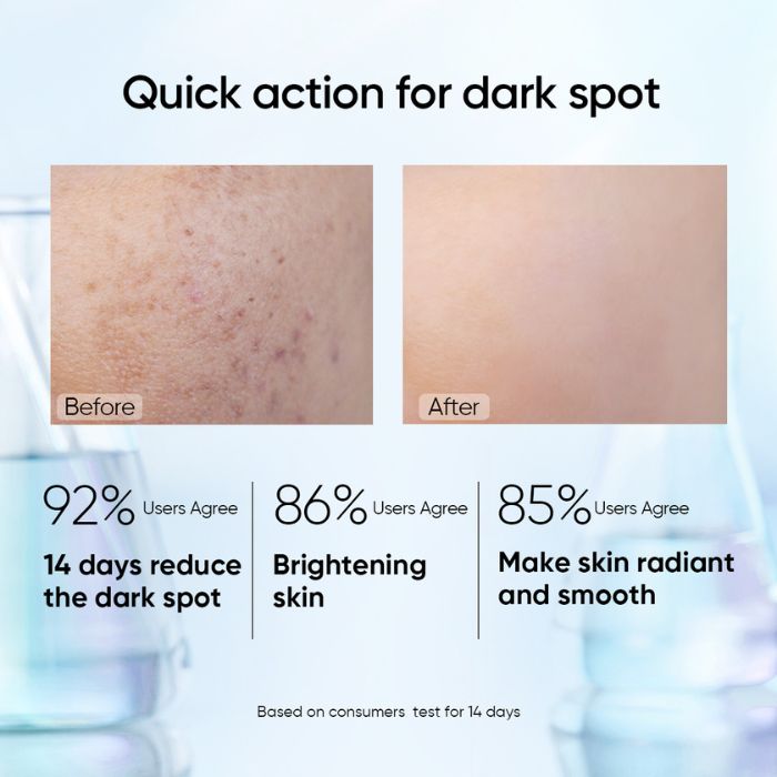 skintific-symwhite-377-dark-spot-serum